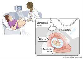 fetal testing during pregnancy