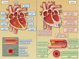 Cardiovascular Alterations and imbalance.